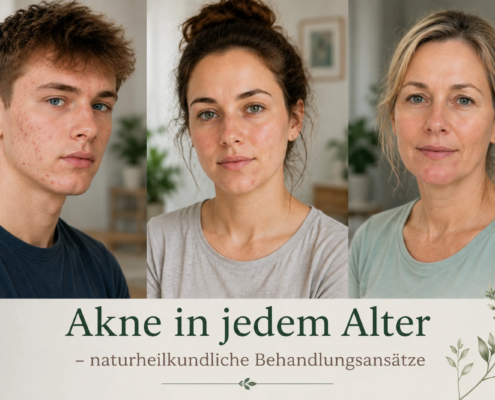 Akne in jedem Alter